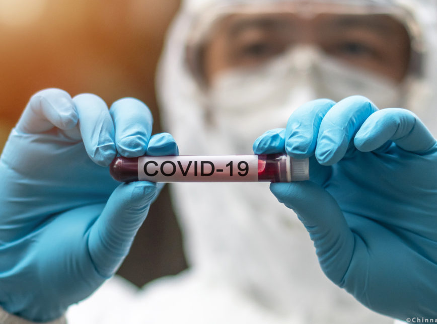 Estado prepara logística para imunização contra a Covid-19