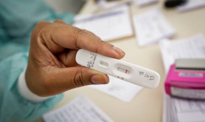 Anvisa deixa de exigir teste de covid-19 para entrada no país