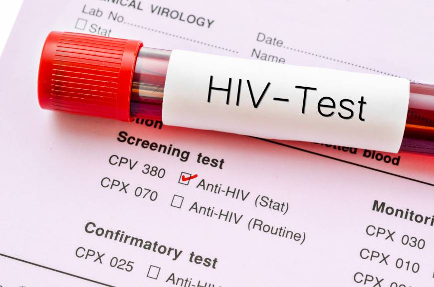 São Marcos tem 85 casos de HIV registrados