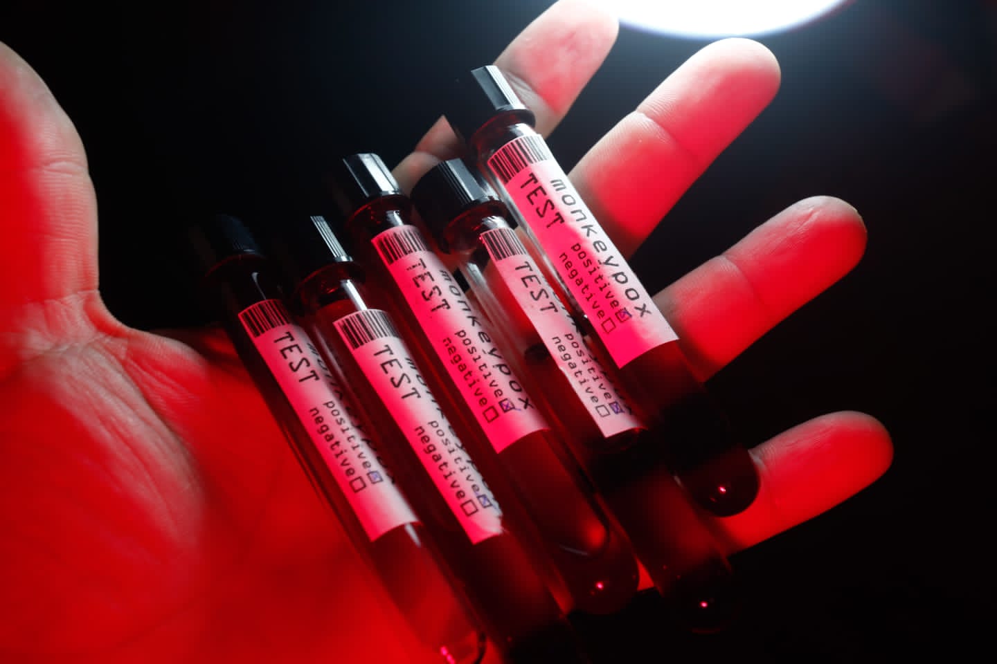 Caxias do Sul confirma primeiro caso de monkeypox