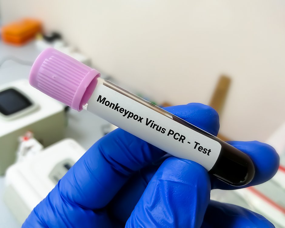 Estado emite alerta epidemiológico sobre a monkeypox