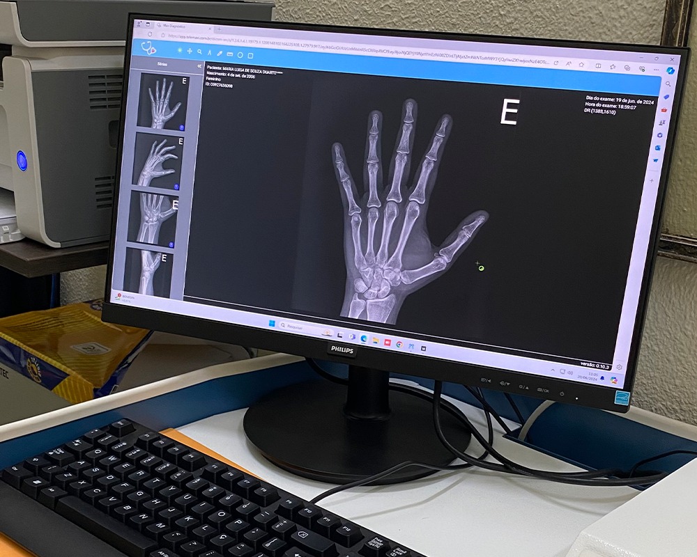 São Marcos inaugura serviço de radiologia e moderniza farmácia de medicamentos especiais