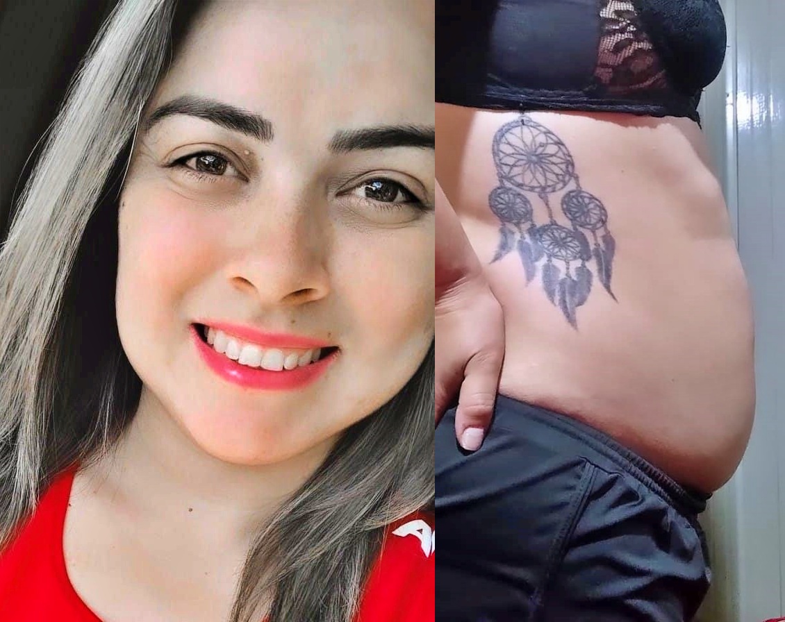 Jovem precisa de ajuda para custear cirurgia de endometriose grave
