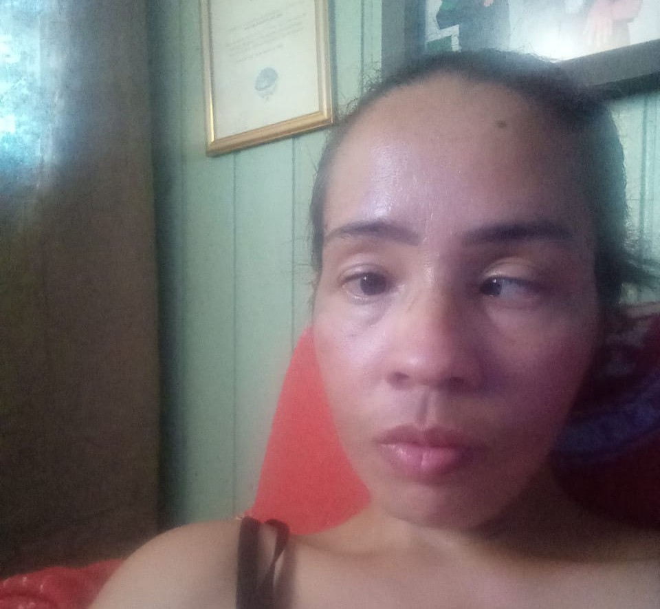 São-marquense promove vaquinha virtual para custear cirurgia nos olhos