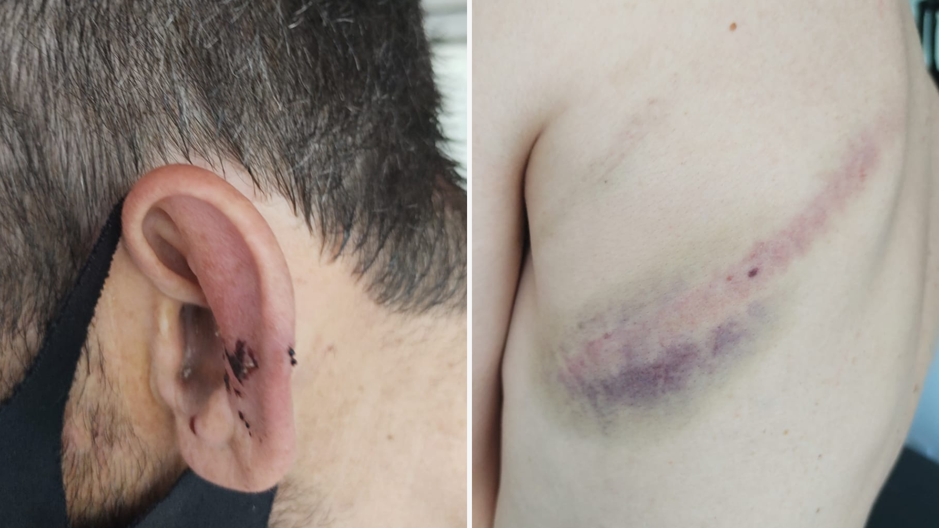 Homem que agrediu idosa em mercado também agrediu pessoa com deficiência