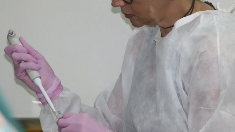 Rio Grande do Sul se torna referência no diagnóstico da monkeypox